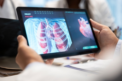 Illustration Supervision de l'IA à l'hôpital : ce qu'il faut avoir organisé avant août 2026