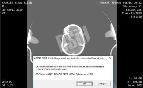 Illustration Sécurité numérique : les attaquants ont-ils toujours un temps d’avance ?